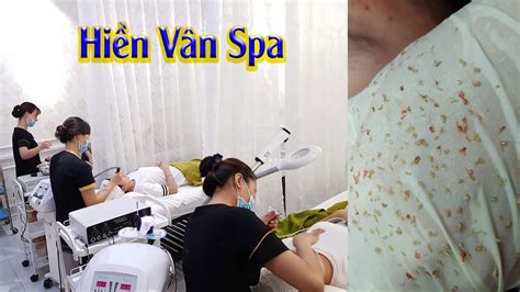 Remove many blackheads, the longest case of acne of the week (139) | Loan Nguyen - Pimple ...