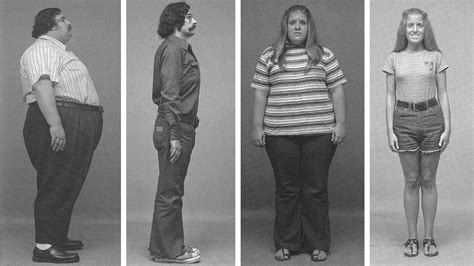 Can Morbid Obesity Be Reversed Through Diet?