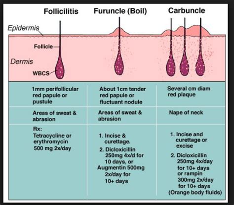 Furuncle Diagram