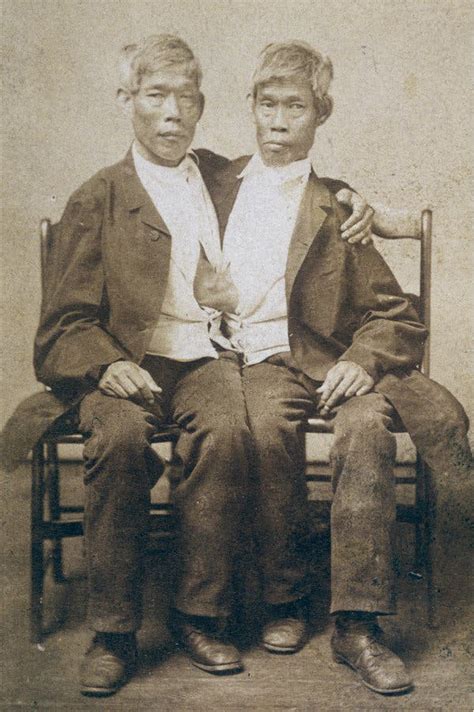 Who Were the Original Siamese Twins? - The New York Times