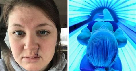 Woman's Selfie Showing What Tanning Beds Did To Her Face Goes Viral