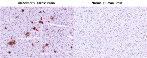 beta-Amyloid(1-42) Monoclonal Antibody – Bioss