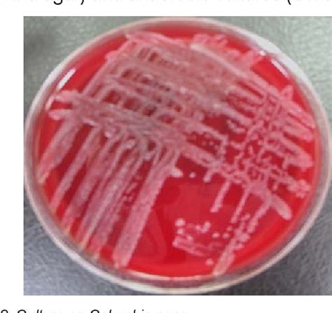 Figure 2 from Pasteurella Canis аs а Cause оf Soft-Tissue Infection after Dog Bite: a Case ...