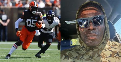 Browns TE David Njoku Reveals Shocking Facial Burns He Suffered In Fire ...