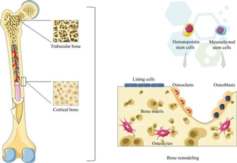 Isolated Bone marrow mesenchymal stem cell transplants - BMSC