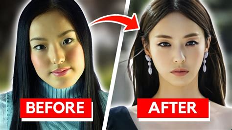 Korean Celebrities Before And After Plastic Surgery