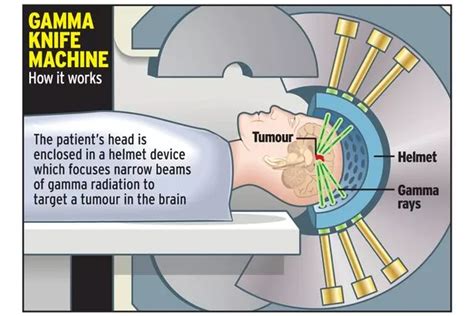 Tinnitus | Page 9 | Audio Science Review (ASR) Forum