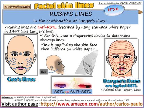 Facial skin lines n°26: Rubin's lines | FACIAL SKIN LINES N°… | Flickr