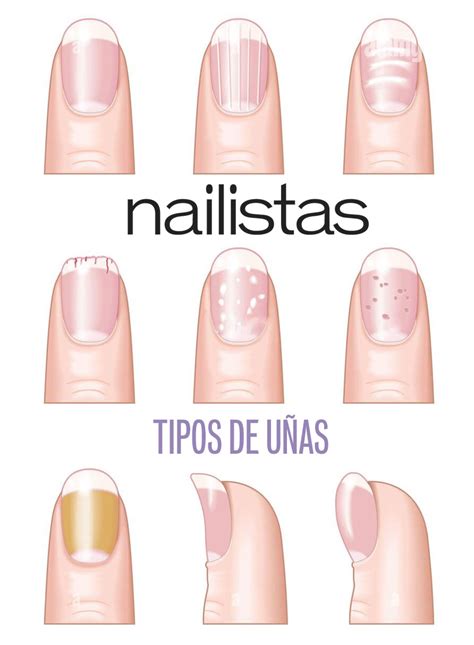 Tipos de uñas: débiles, estriadas. Problemas + soluciones.