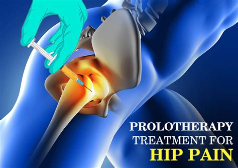 Hip Pain in People - Arthritis and Joint Degeneration