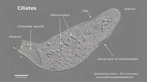 The Micro Universe - Microscopic life by Robert Berdan - The Canadian ...