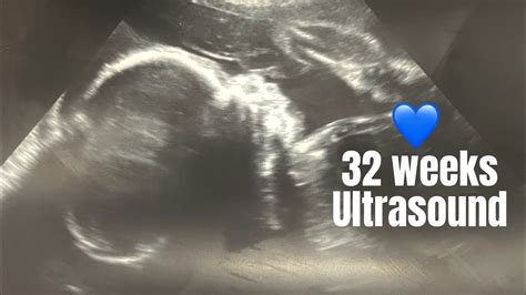 32 Weeks Pregnancy Ultrasound Baby Moving/Drinking - YouTube