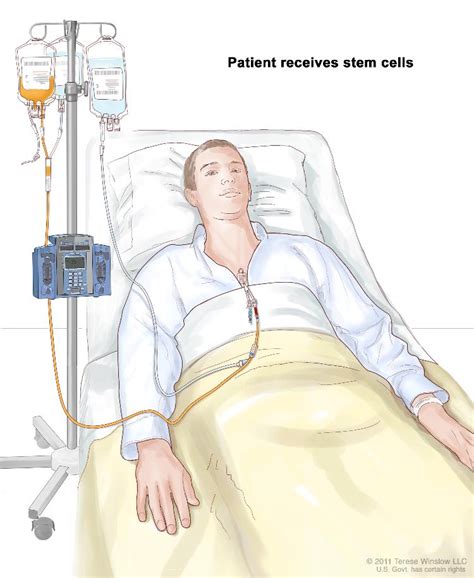 Chemotherapy Treatment For Leukemia