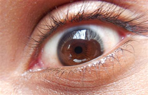 File:The human eye.JPG - Wikimedia Commons