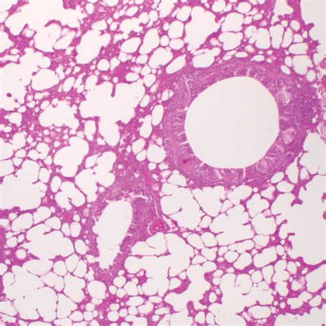 Mammal Lung Slide, 8 µm, H&E | Carolina Biological Supply