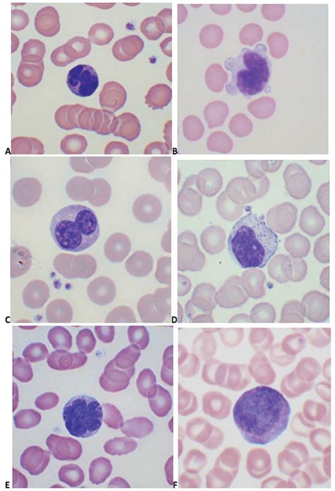 Pre-morbid human T-lymphotropic virus type I proviral load, rather than ...