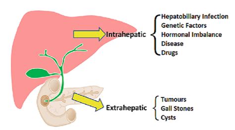 Cholestatic Liver Disease - Health Article | Drlogy