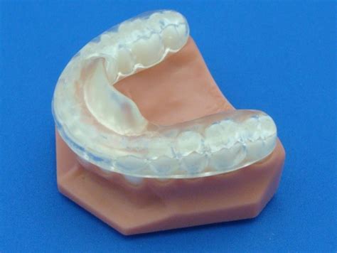 Anterior Repositioning Splint | News | Dentagama