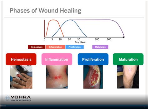 What Are The Different Stages Of Wound Healing - BEST HOME DESIGN IDEAS