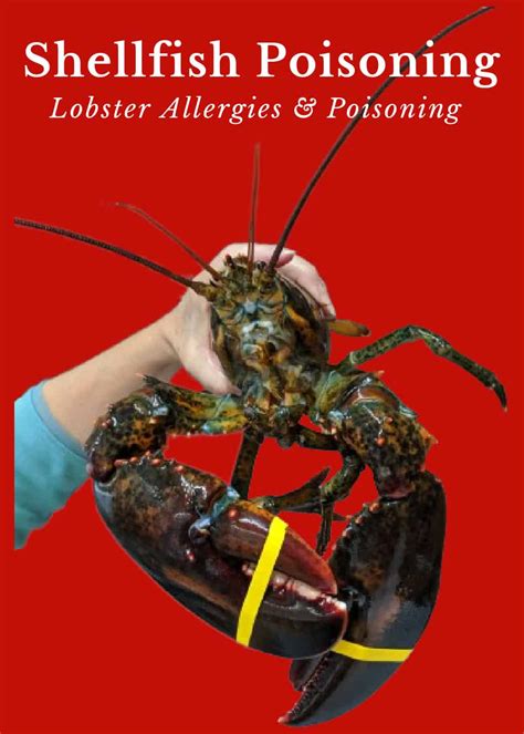 Lobster Poisoning: Can Lobster Make you Sick?