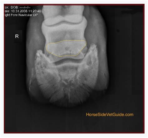 Understanding Navicular Syndrome & Heel Pain in Horses