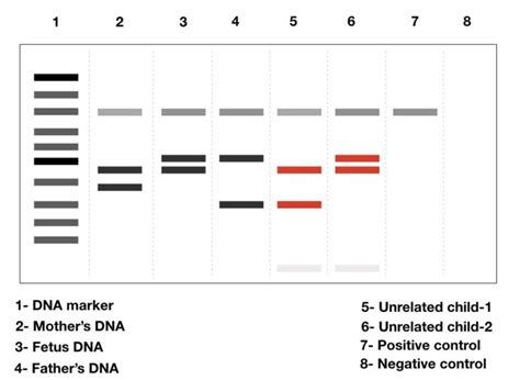 DNA Fingerprinting- Definition, Steps, Methods and Applications