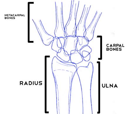 Wrist Fractures