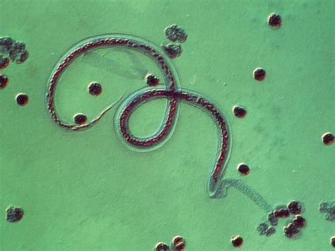 Parasites In Legs Humans | ... - The enemy within: 10 human parasites - Image 7 - New Scientist ...