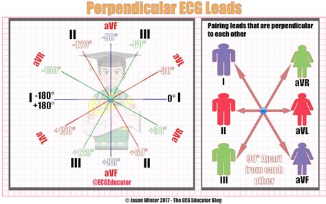 ECG Educator Blog : Cardiac Axis Made Easy