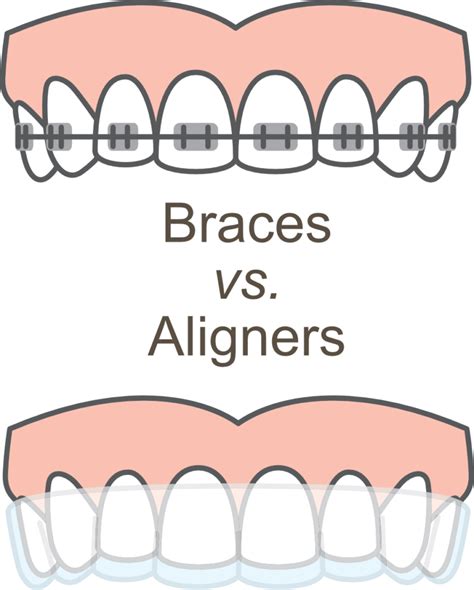 Braces vs Clear Aligners. Which Is Better? Complete Patient Guide