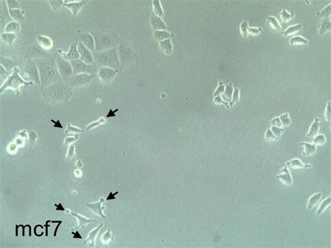 Morphological changes in MCf7 cell line? | ResearchGate