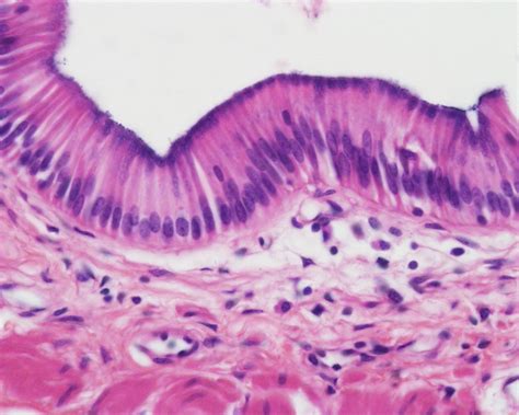 Simple Columnar Epithelium; single layer of cells cells are roughly ...