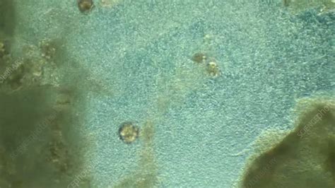 Bacteria shimmering in pond water - Stock Video Clip - K003/5582 - Science Photo Library