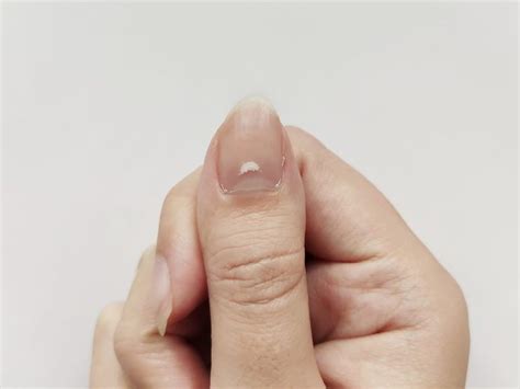 Here's What the White Spots on Your Nails Mean | Reader's Digest