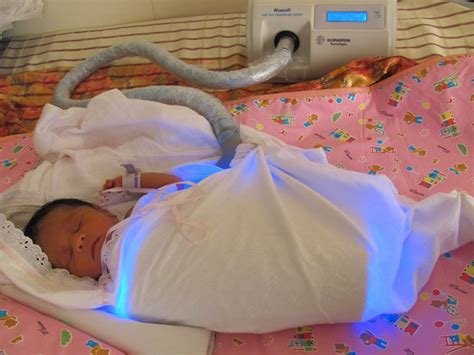 Biophoton BiliBlanket Phototherapy System, Embrace Phototherapy, For ...