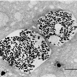 General life cycle of microsporidia | Download Scientific Diagram