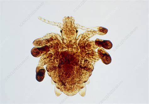 Light micrograph of Phthirus pubis, the crab louse - Stock Image - Z265 ...