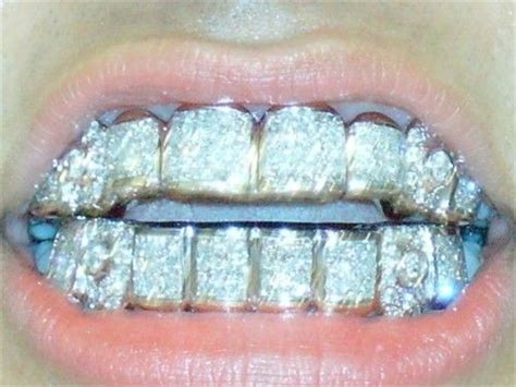 goldenfleecing - diamond grill! | Diamond teeth, Gold teeth, Grillz