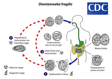 Dientamoeba fragilis infection, life cycle, symptoms, diagnosis & treatment