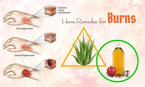 Pin on Home Remedies