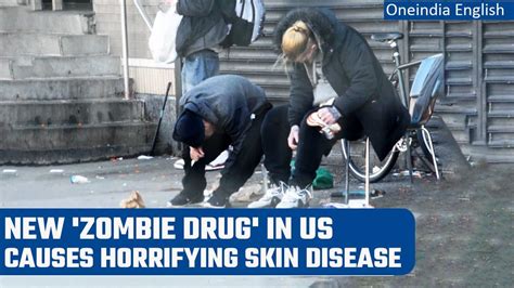 Xylazine: 'Zombie drug' causes menace in US as - One News Page VIDEO