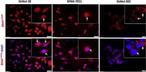 Nuclear localization of BRAF V600E in melanoma cells. SkMel-28 and ...