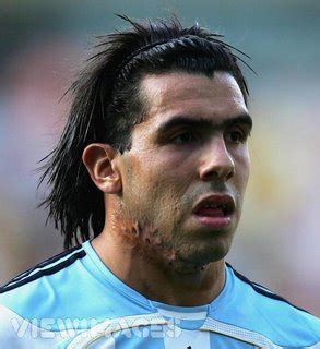 How Carlos Tevez got his Neck Scars - FootyBlog.net