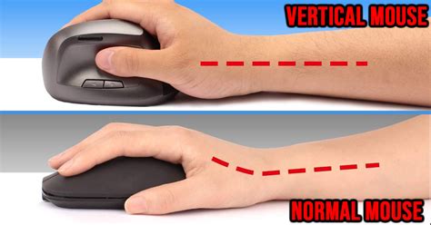 Vertical Ergonomic Mouse: What a Vertical Mouse Is & It's Better - Goody Feed