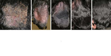 Pemphigus Foliaceus - The Skin Vet