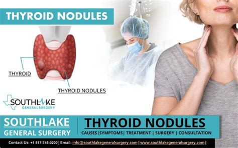 thyroid nodules diagnosis Archives - Southlake General Surgery