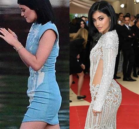 Kylie Jenner Before and after: Nose Job, Lip Injections, Breast