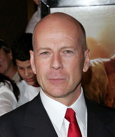 35 Photos of Bald Celebrities When They Had Hair – Bald Actors