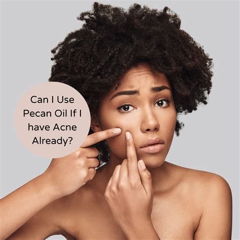 Can I Use Pecan Oil If I have Acne Already? | Nuez Acres
