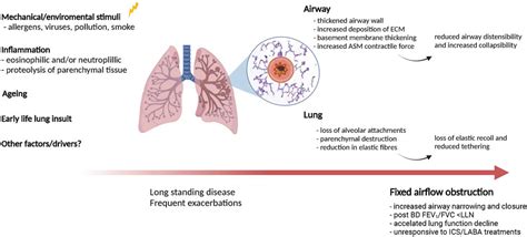 Specificità Grato stagionatura air trapping asthma treatment Come ...